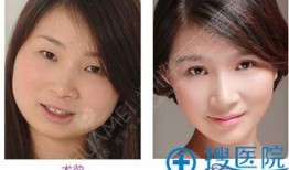 福州整形爆料事件视频最新,揭露行业黑幕，真相令人震惊